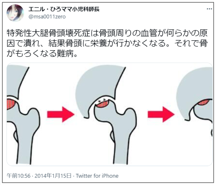 ケツメイシryoji持病