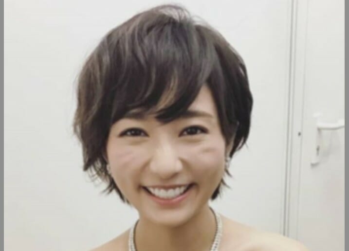 木村文乃笑顔しわ不自然