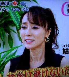 浅野ゆう子の首のシワ手術