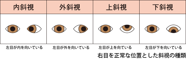 村方乃々佳の目が斜視で怖い