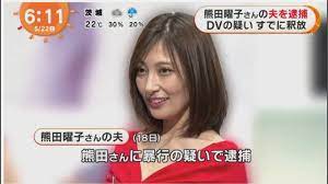 熊田曜子あざ腕の画像