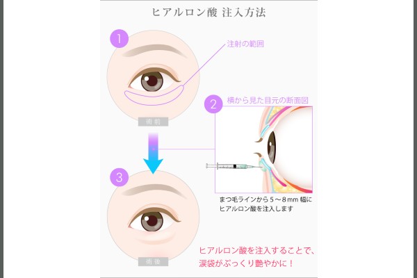 大塚愛の悲報と現在の顔