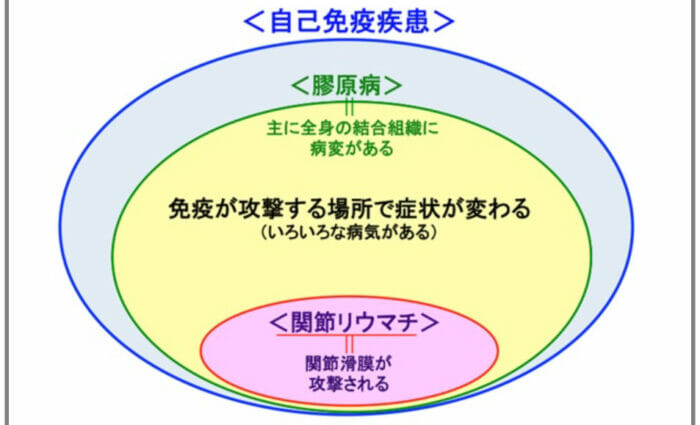 高市早苗がん病気ウィッグ