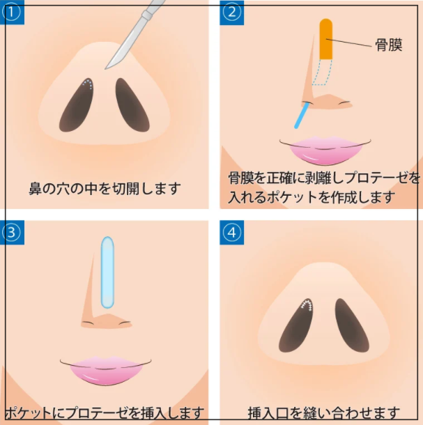 高梨沙羅の顔変わり過ぎ