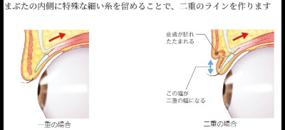 若槻千夏が可愛くなった鼻筋