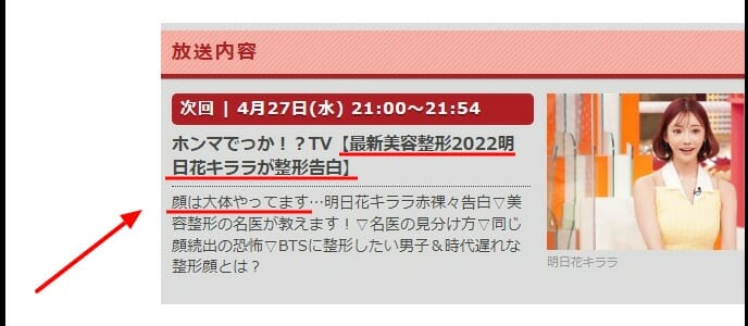 明日花キララ顔と昔違う整形