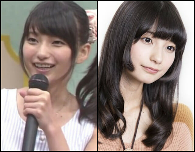 高野麻里佳の整形と昔