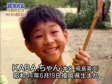 KABAちゃん顔崩壊と現在昔