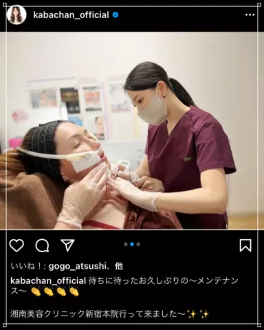 KABAちゃん顔崩壊と現在昔