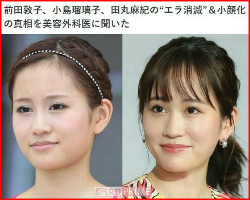 前田敦子の顔変わったエラ