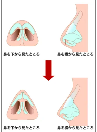 ルセラフィムのカズハ二重